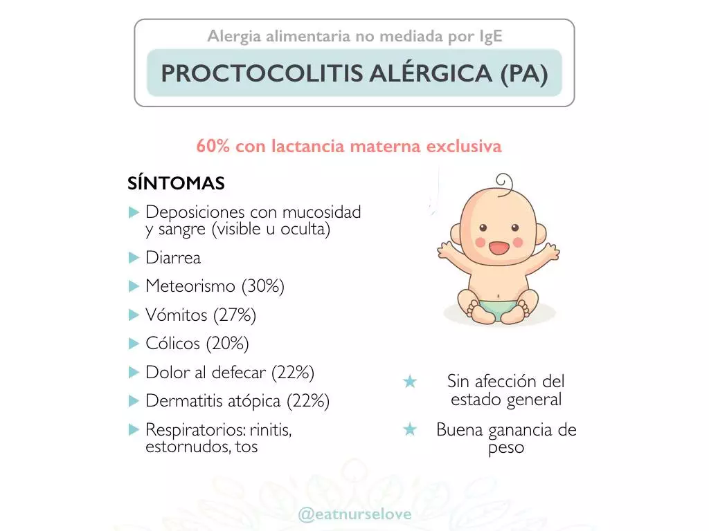 Proctocolitis alérgica 2.001